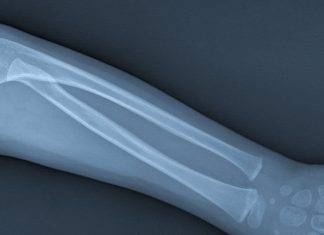Tips on Dealing with an Injured Child