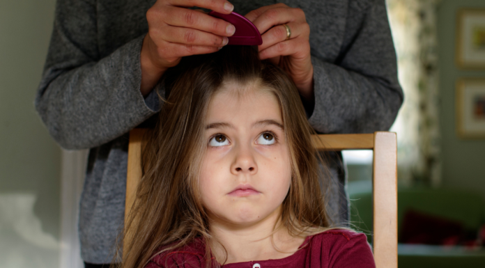 head lice